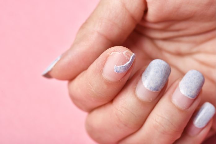 Why Do Acrylic Nails Hurt the First Day: Understanding the Causes